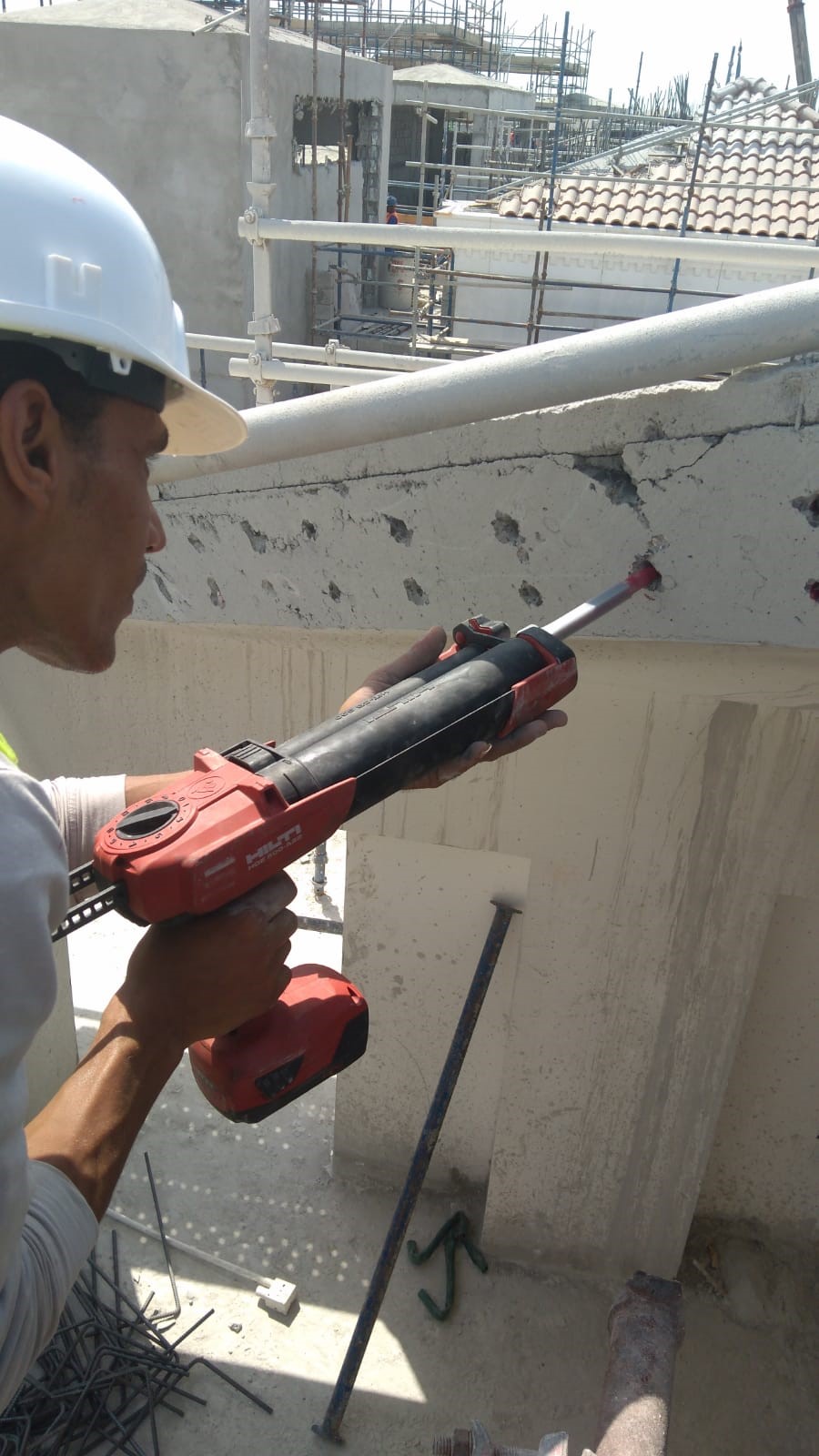 Anchor fixing
